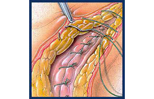 1515374583881936.jpg 02.jpg